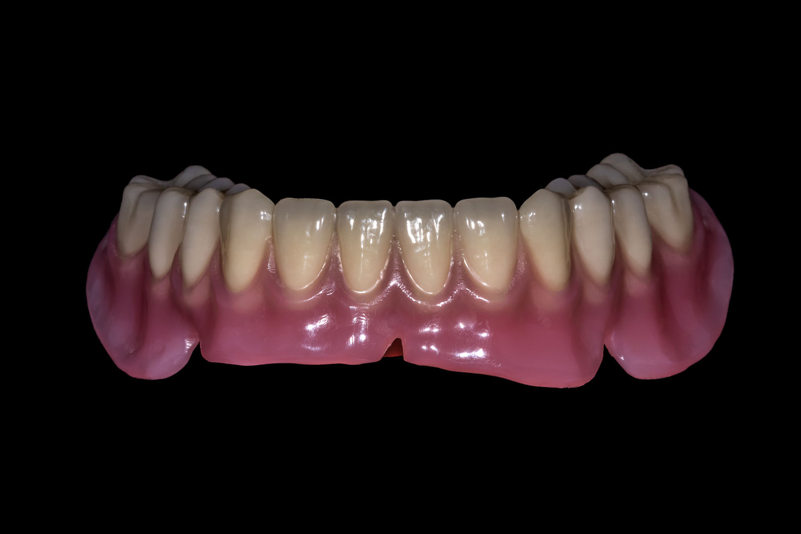 Fogsorok (3D nyomtatott) | 3D Printed Dentures